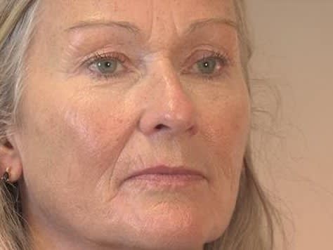 TIRED OF AGEING