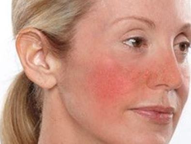 YES WRINKLES