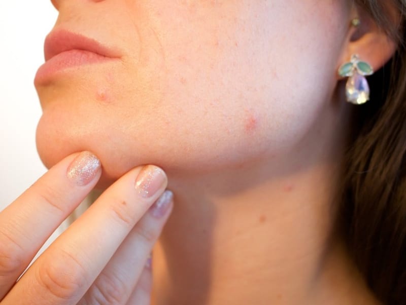 How would you describe your skin at a first glance?
