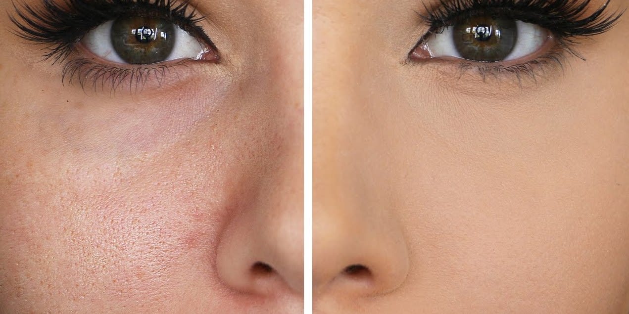 How would you describe your pores?