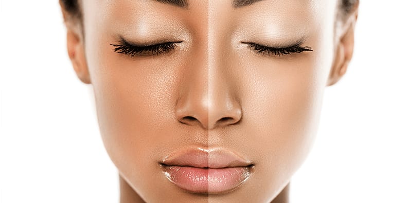 What Type of Skin Do You Have?