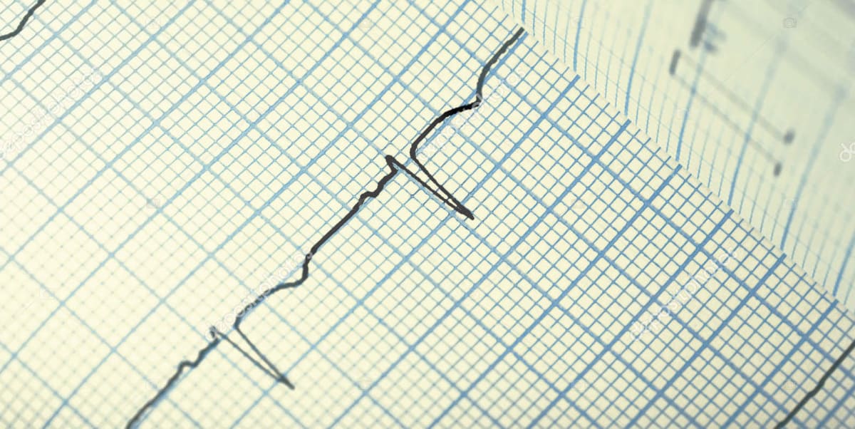 تخطيط القلب كيف تقرأه How To Read Ecg مدونة طالب طب