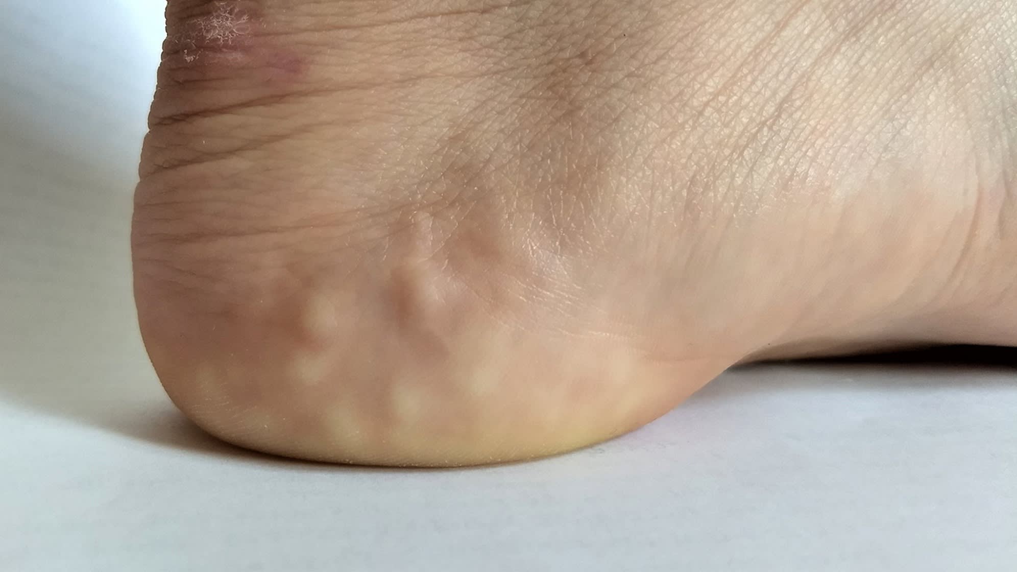 Heel