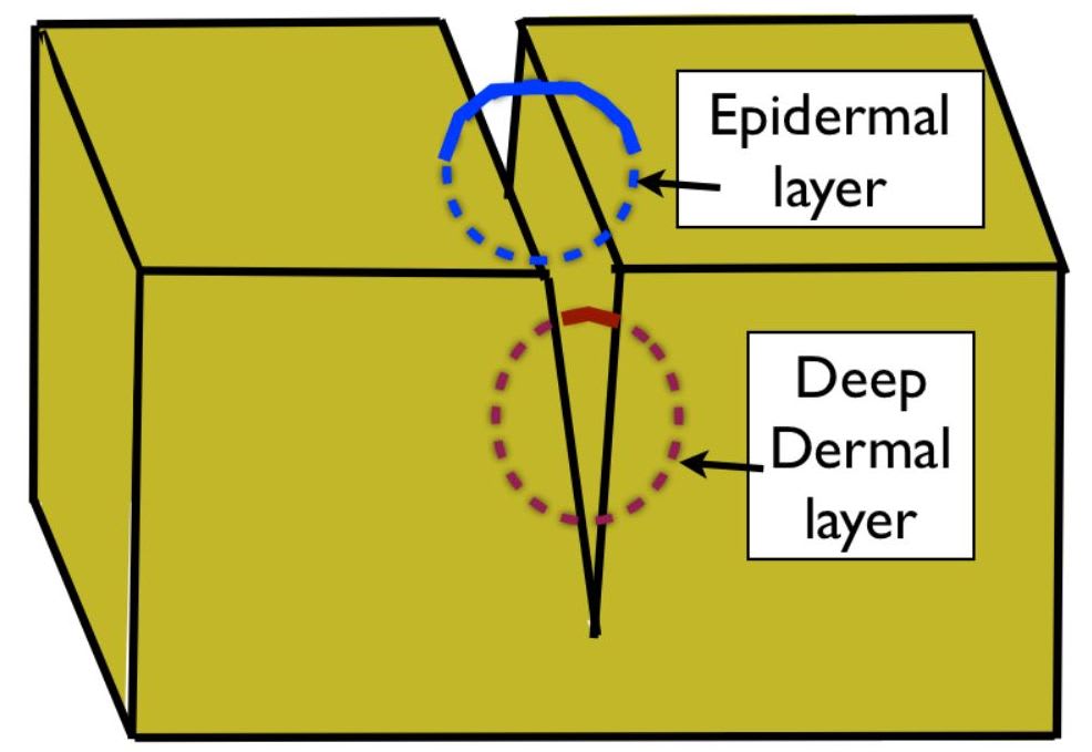 layered repair