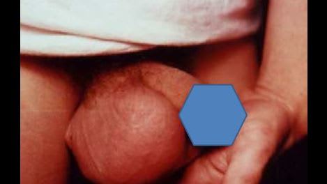 Epidid long