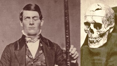 phineas-gage-s