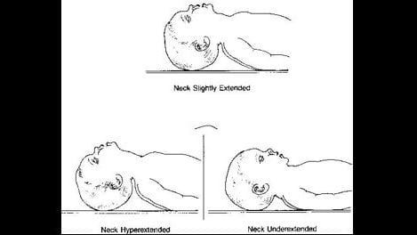 neck long