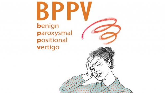 BPPV