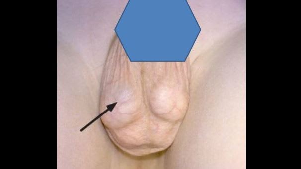 Blue dot long