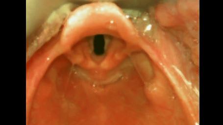 larynx long