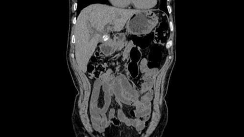 ct stone long