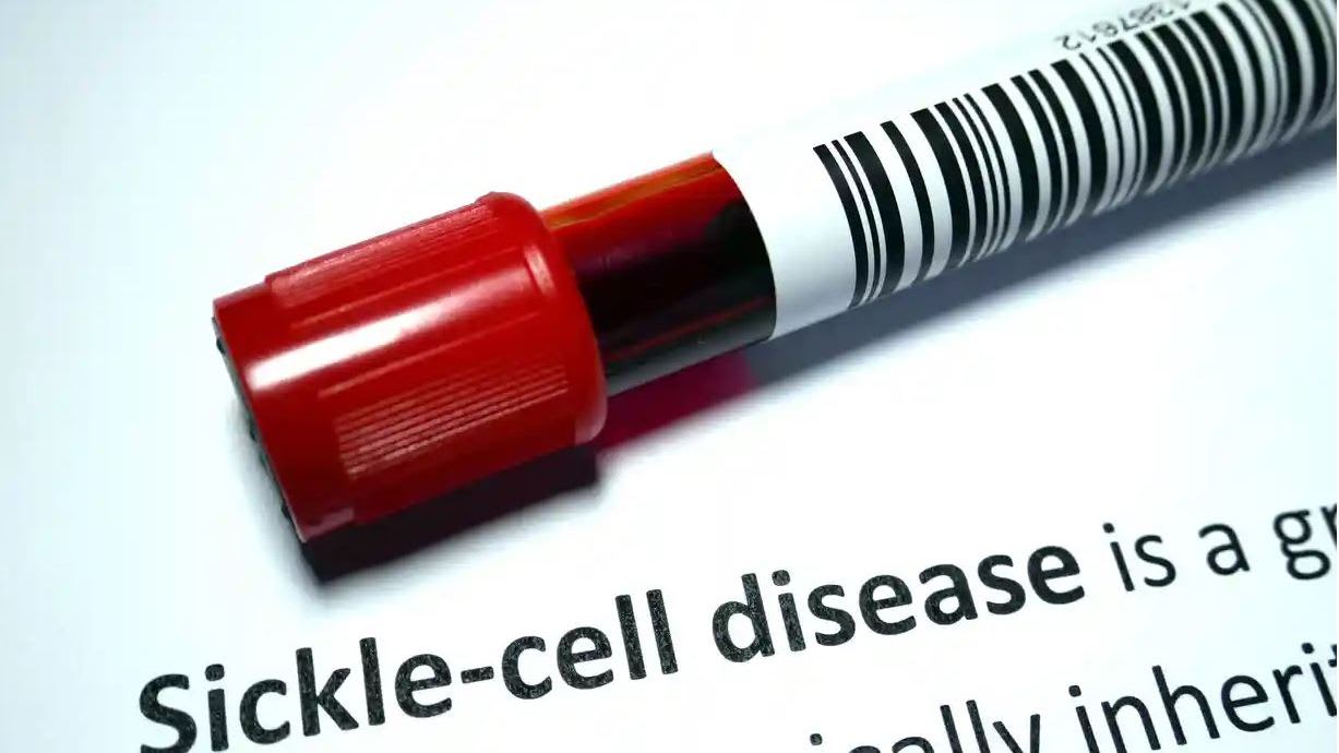 Blood Test Tube