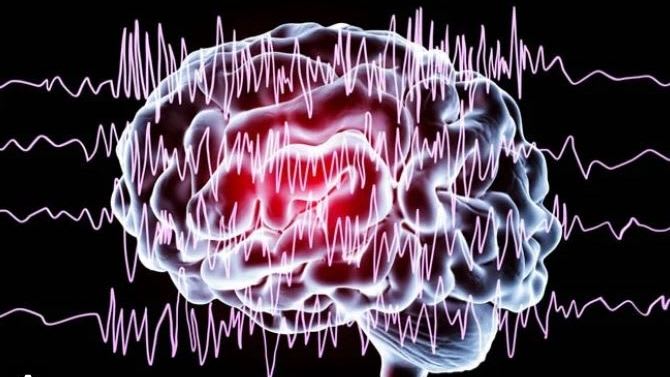 Status epilep brain