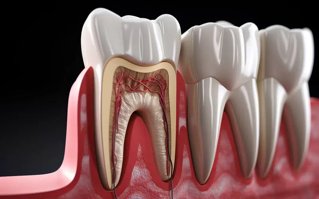 Tooth-Enamel-Loss-and-Irreversible-Damage-1080x675