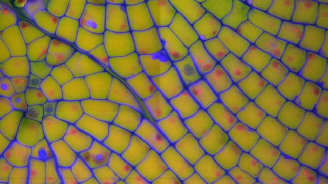 Stained_cross-sections_of_plants_revealing_patterns_of_plant_cell_growth