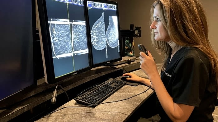 breast biopsy